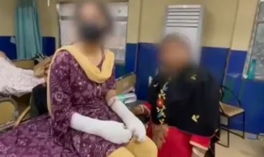 एसिड अटैक केस में चौंकाने वाला खुलासा: पीड़िता के पिता कबूला गुनाह, रची थी झूठी साजिश