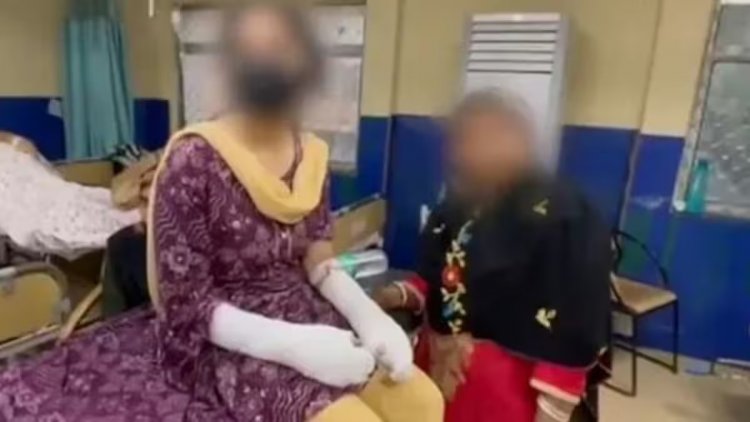 एसिड अटैक केस में चौंकाने वाला खुलासा: पीड़िता के पिता कबूला गुनाह, रची थी झूठी साजिश