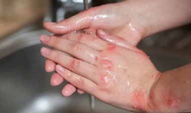 सर्दियों में बर्तन धोने से हाथ हो रहे हैं खराब? अपनाएं ये आसान टिप्स और रखें हाथों को कोमल