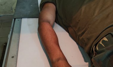 पर्यटन मंत्री राजेश अग्रवाल के काफिले की गाड़ी पलटी,जवान को आई गम्भीर चोट, हेड कांस्टेबल घायल