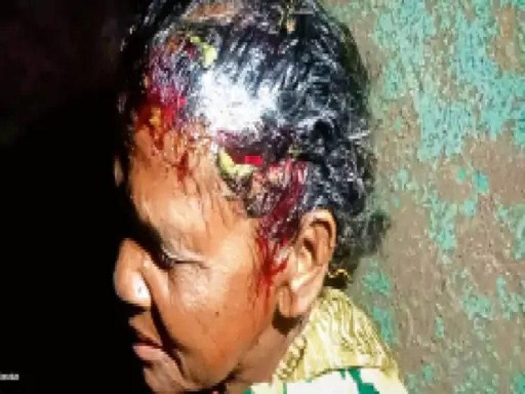 दुधावा क्षेत्र में आदमखोर तेंदुए का आतंक, 5 दिनों में 3 लोगों पर हमला, ग्रामीणों में दहशत