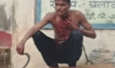 बालोद में युवक ने हंसिए से रेता अपना ही गला: गंभीर हालत में अस्पताल में भर्ती; इलाके में सनसनी, जांच में जुटी पुलिस